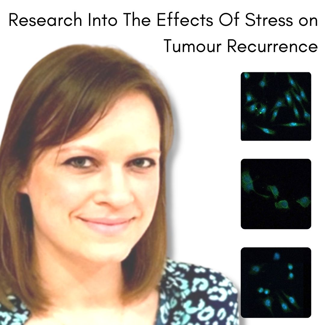 update-research-into-the-effects-of-stress-on-tumour-recurrence